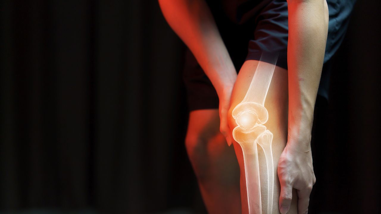 Joint Pain 2