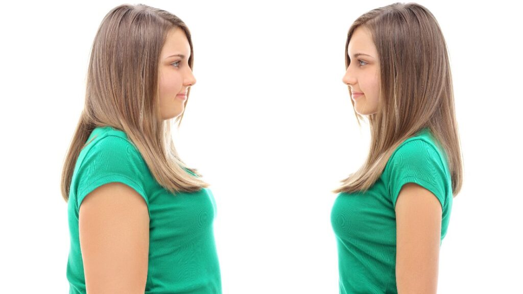 Weight loss 2 Weight loss 2