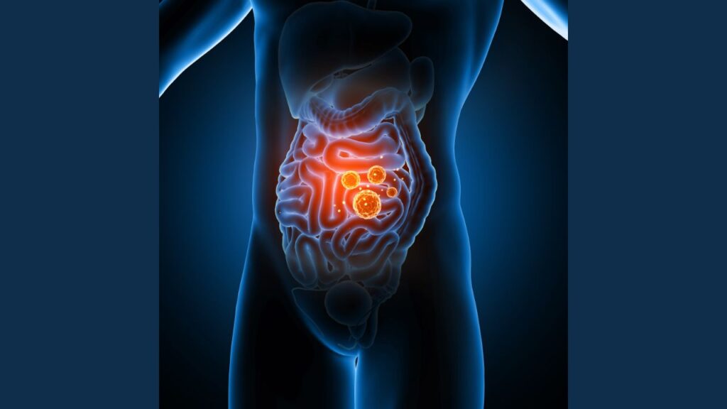 Anti Inflammatory Diet 3 Anti Inflammatory Diet 3